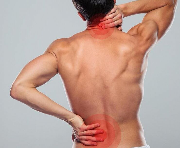 Một người đàn ông bị bệnh xương khớp cột sống